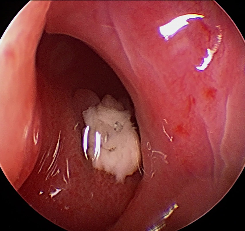 fístula oronasal en perro vista por rinoscopia veterinaria