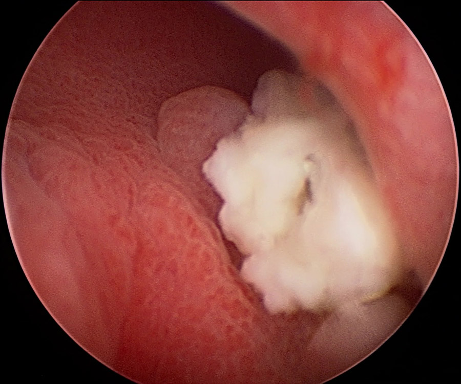 rinoscopia veterinaria en perro con enfermedad periodontal